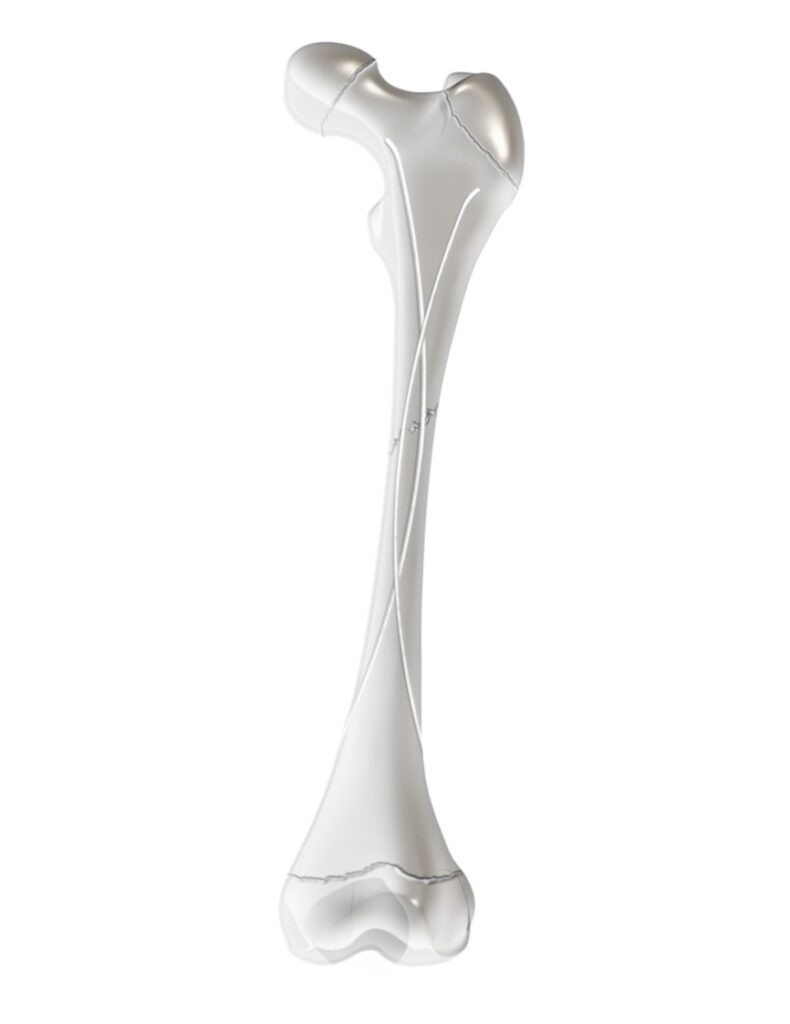 PediFlex Advanced
